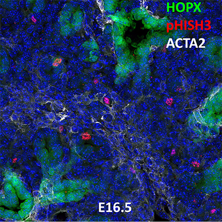 E16.5 C57BL6 HOPX, pHISH3, and ACTA2 Confocal Imaging