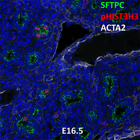 E16.5 C57BL6 SFTPC, pHISH3, and ACTA2 Confocal Imaging