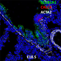 E18.5 C57BL6 SCGB1A1, CALCA, and ACTA2 Confocal Imaging