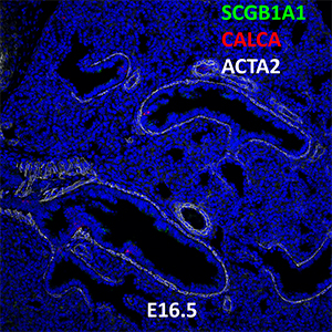 E16.5 C57BL6 SCGB1A1, CALCA, and ACTA2 Confocal Imaging