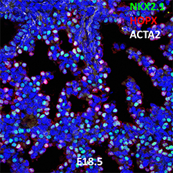 E18.5 C57BL6 HOPX, NKX2.1, and ACTA2 Confocal Imaging