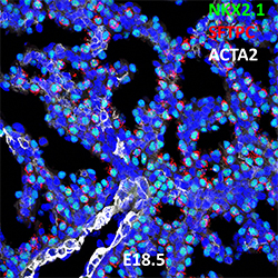 E18.5 C57BL6 NKX2.1, SFTPC, and ACTA2 Confocal Imaging