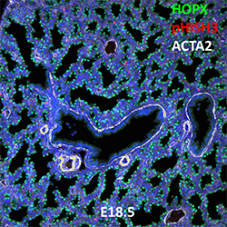 E18.5 C57BL6 HOPX, pHISH3, and ACTA2 Confocal Imaging