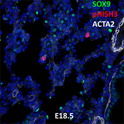 E18.5 C57BL6 SOX9, pHISH3, and ACTA2 Confocal Imaging