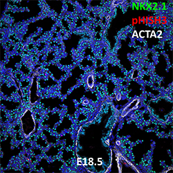 E18.5 C57BL6 NKX2.1, pHISH3, and ACTA2 Confocal Imaging