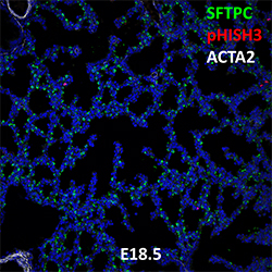 E18.5 C57BL6 SFTPC, pHISH3, and ACTA2 Confocal Imaging
