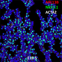 E18.5 C57BL6 ARL13B, NKX2.1, and ACTA2 Confocal Imaging