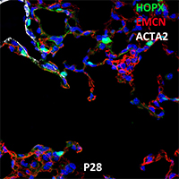 Postnatal Day 28 C57BL6 HOPX, EMCN, and ACTA2 Confocal Imaging