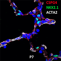 Postnatal Day 7 C57BL6 CSPG4, NKX2.1, and ACTA2 Confocal Imaging