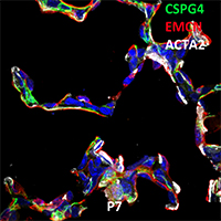 Postnatal Day 7 C57BL6 CSPG4, EMCN, and ACTA2 Confocal Imaging