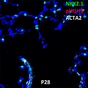 Postnatal Day 28 C57BL6 NKX2.1, pHISTH3, and ACTA2 Confocal Imaging