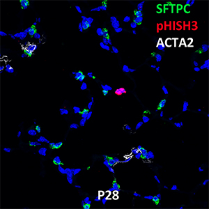 Postnatal Day 28 C57BL6 SFTPC, pHISTH3, and ACTA2 Confocal Imaging
