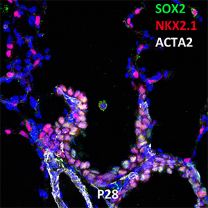 Postnatal Day 28 C57BL6 SOX2, NKX2.1, and ACTA2 Confocal Imaging