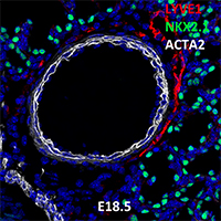 E18.5 C57BL6 LYVE1, NKX2.1, and ACTA2 Confocal Imaging