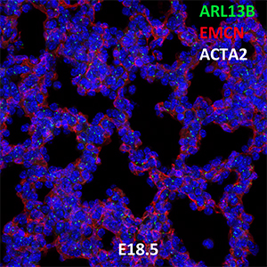 E18.5 C57BL6 ARL13B, EMCN, and ACTA2 Confocal Imaging