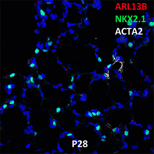 Postnatal Day 28 C57BL6 ARL13B, NKX2.1, and ACTA2 Confocal Imaging