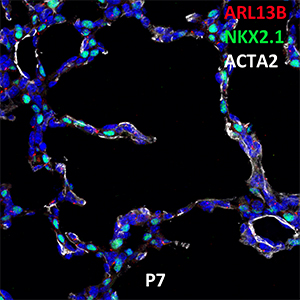 Postnatal Day 7 C57BL6 ARL13B, NKX2.1, and ACTA2 Confocal Imaging
