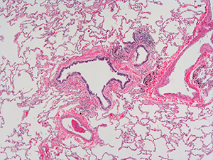 H&E Staining of 31 Year Old Human Lung