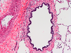 H&E Staining 31 Year Old Human Lung DD034L-03HF-1