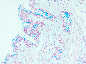 Alcian Blue Staining of 31 Year Old Human Lung DD034L-03HP-2