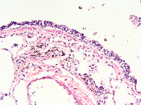 H&E Staining 31 Year Old Human Lung DD034L-03HF-2