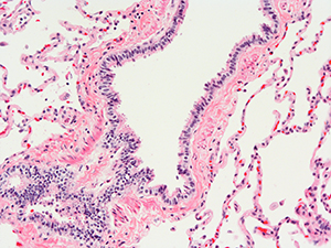 H&E Staining 31 Year Old Human Lung DD034L-03HP-2