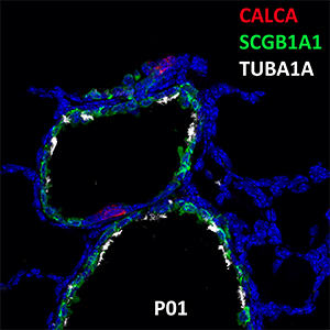 Postnatal Day 1 C57BL6 CALCA, SCGB1A1, and TUBA1A Confocal Imaging