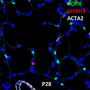Postnatal Day 28 C57BL6 HOPX, pHISTH3, and ACTA2 Confocal Imaging