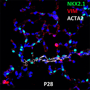 Postnatal Day 28 C57BL6 NKX2.1, VIM, and ACTA2 Confocal Imaging