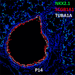 Postnatal Day 14 C57BL6 NKX2.1, SCGB1A1, and TUBA1A Confocal Imaging