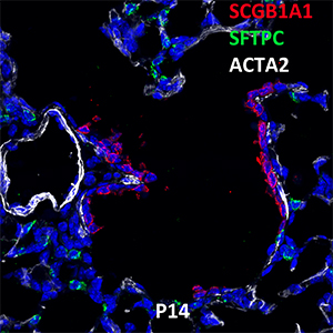 Postnatal Day 14 C57BL6 SFTPC, SCGB1A1, and ACTA2 Confocal Imaging