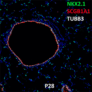 Postnatal Day 28 C57BL6 NKX2.1, SCGB1A1, and TUBB3 Confocal Imaging