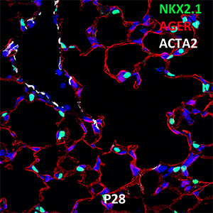 Postnatal Day 28 C57BL6 NKX2.1, AGER, and ACTA2 Confocal Imaging