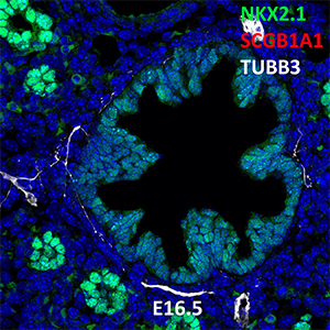 E16.5 C57BL6 NKX2.1, SCGB1A1, and TUBB3 Confocal Imaging