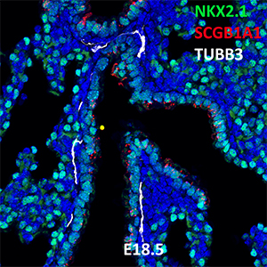E18.5 C57BL6 NKX2.1, SCGB1A1, and TUBB3 Confocal Imaging