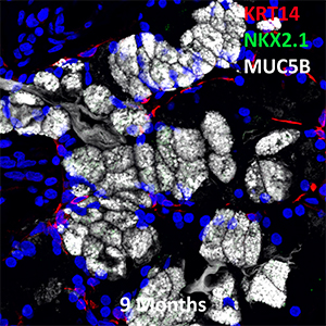 9 Month Old Human Lung KRT14, NKX2.1, and MUC5B Confocal Imaging