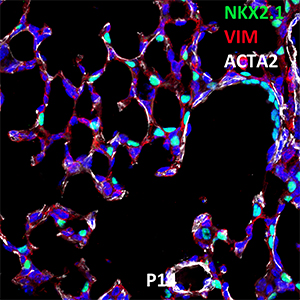 Postnatal Day 14 C57BL6 NKX2.1, VIM, and ACTA2 Confocal Imaging