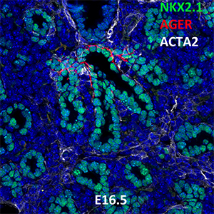 E16.5 C57BL6 NKX2.1, AGER, and ACTA2 Confocal Imaging