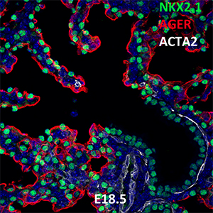 E18.5 C57BL6 NKX2.1, AGER, and ACTA2 Confocal Imaging