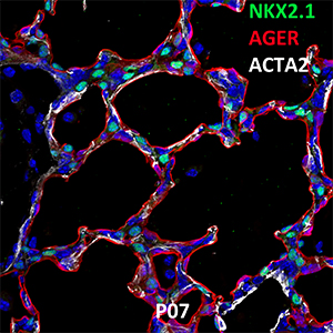 Postnatal Day 7 C57BL6 NKX2.1, AGER, and ACTA2 Confocal Imaging
