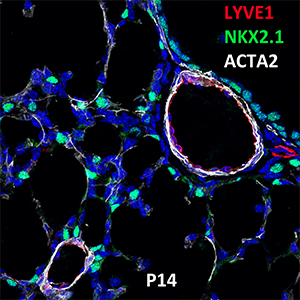Postnatal Day 14 C57BL6 LYVE1, NKX2.1, and ACTA2 Confocal Imaging