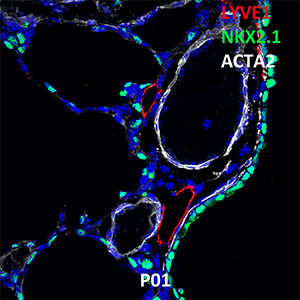 Postnatal Day 1 C57BL6 LYVE1, NKX2.1, and ACTA2 Confocal Imaging