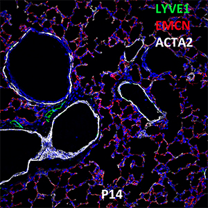 Postnatal Day 14 C57BL6 LYVE1, EMCN, and ACTA2 Confocal Imaging