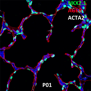Postnatal Day 1 C57BL6 NKX2.1, AGER, and ACTA2 Confocal Imaging