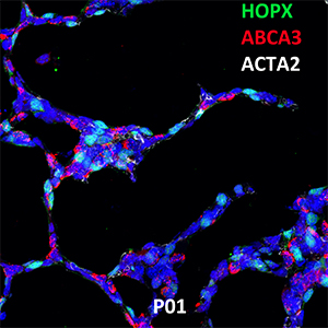 Postnatal Day 1 C57BL6 HOPX, ABCA3, and ACTA2 Confocal Imaging