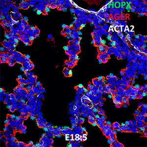 E18.5 C57BL6 HOPX, AGER, and ACTA2 Confocal Imaging