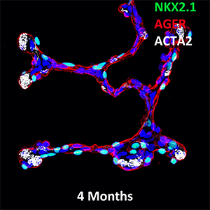 4 Month Human Lung NKX2.1, AGER, and ACTA Confocal Imaging
