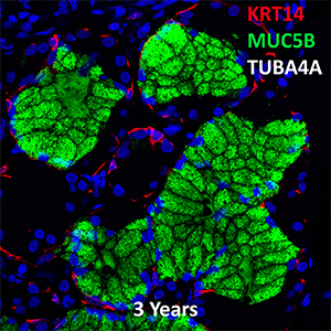 3 Year Human Lung LMH, KRT14, MUC5B, and TUBA4A Confocal Imaging