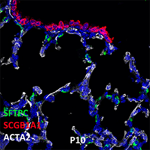Postnatal Day 10 C57BL6 SFTPC, SCGB1A1, and ACTA2 Confocal Imaging
