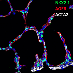 Postnatal Day 03 C57BL6 NKX2.1, AGER, and ACTA2 Confocal Imaging